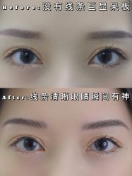 -OnFaer.纹眉半永久无创洗眉