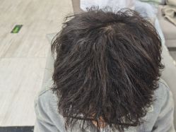 -雍禾植发