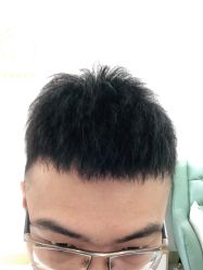 -发饰美男士增发补发假发定制店