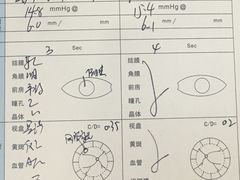 -黑马眼科·近视手术