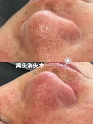 -Cream88颜皮肤管理中心