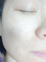 体验前-坤如玛丽·医疗美容中心