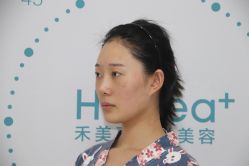 体验前-禾美嘉医疗美容