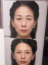 -长沙雅美医疗美容医院