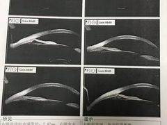 -上海大学附属上海和平眼科医院