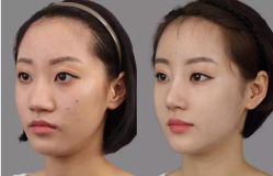 -SKINIST丽铂医疗美容