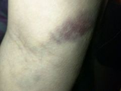 -北京中西医结合医院