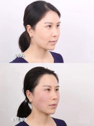 -泉州欧菲医疗美容