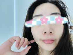 体验后-贞禾医美·连锁