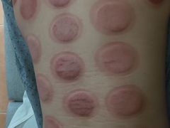 -孙三拨按摩拨筋(五一路店)