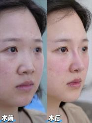 -Yestar重庆艺星医疗美容医院