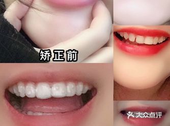 我做过的性价比最高的医美项目