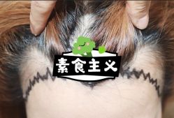 -大麦微针植发全国连锁