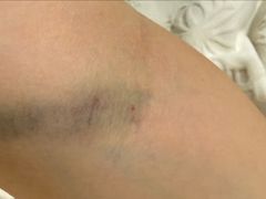 -四川省人民医院(本部)