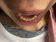 -宁波壹加壹口腔·矫正种植中心