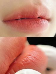 -MeVius 美薇私·皮肤管理中心