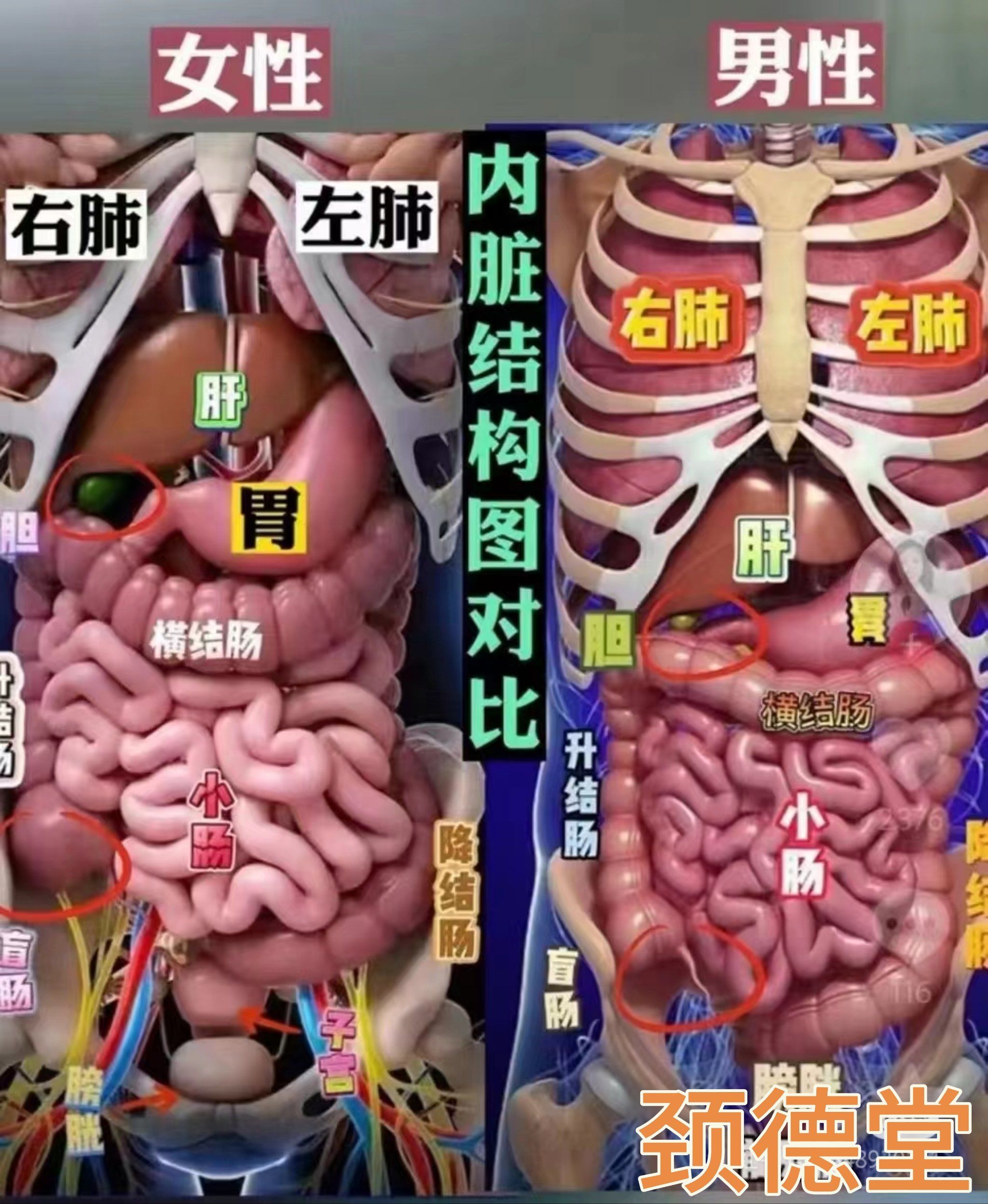 腰椎脊柱侧弯你会发现凹侧的肠道也是粘粘的