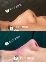 -北京米扬丽格医疗美容·联合丽格鼻整形中心