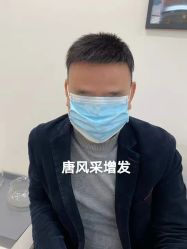 -唐风采假发补发定制