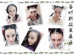 -大麦微针植发全国连锁