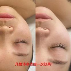 点击看大图 -凡碧诗毛孔清洁收细