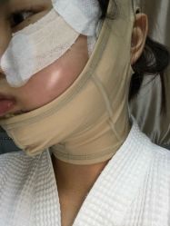 体验后-上海首尔丽格医疗美容医院