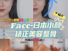 -FACE·日本小颜美容整骨(福田店)