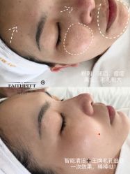 -凡碧诗毛孔收细