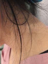 -美瑞莎创美医疗美容