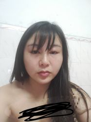 体验后-赫思整形医疗