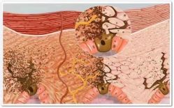 -美肤盾祛痘·问题肌头疗管理中心