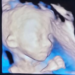-重庆安琪儿妇产医院-妇幼保健联盟医院