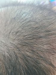 -雍禾植发全国连锁