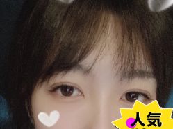 -U-Nail