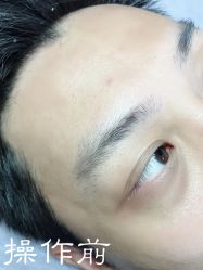 -西施无菌半永久纹绣眉眼影唇轻增发纹发际线
