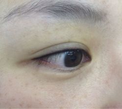 隐形眼线-平萍纹绣韩式半永久定妆