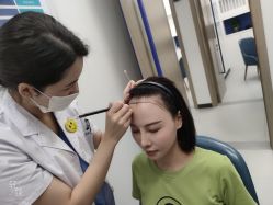 -大麦微针植发全国连锁