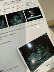 -上海百佳妇产医院