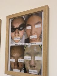 -美肤盾祛痘·问题肌头疗管理中心