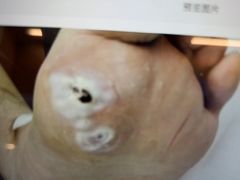 -郑远元专业修脚房·按摩·肉刺·灰指甲(苏绣路店)