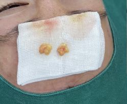 -天津健丽·去眼袋医疗美容机构