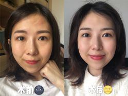 -深圳阳光医疗美容医院·旗舰店