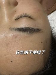 -清疣美疣·痣·斑净肤中心