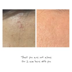 -夸迪QUADHA肌肤定制