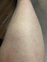 体验前-深圳鹏爱悦心医疗美容医院