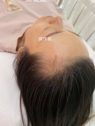 -MISS STAR·半永久纹眉·发际线·美瞳线