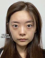 体验前-杭州奥拉克医疗美容门诊部