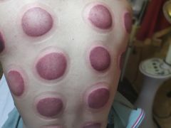 -御筋堂正骨推拿(星源国际店)