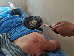 -张钰强中医正骨推拿连锁(唐家人才公寓店)