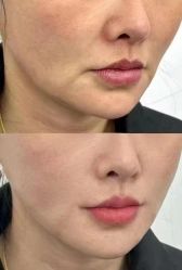 -美愈美肤MEIYU SKIN